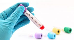 Nuevo RD de Legionella: FEGECA explica los requisitos para los depósitos de ACS